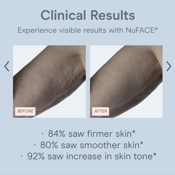 NuBody kit- device & serum! This is the real deal!! - Picture 12 of 16